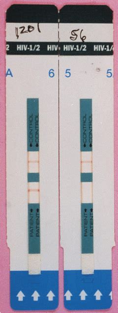 how to read hiv test results
